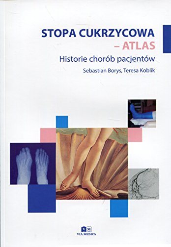 Książka - Stopa cukrzycowa - atlas