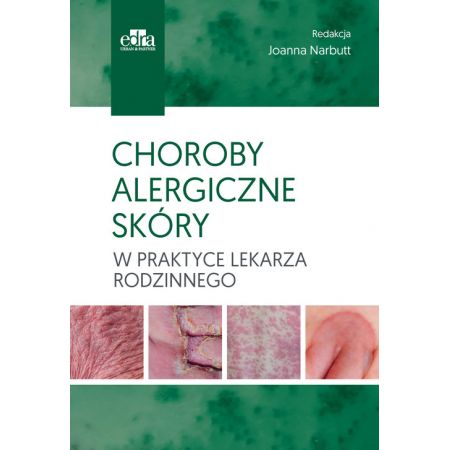 Książka - Choroby alergiczne skóry w praktyce lekarza rodzinnego