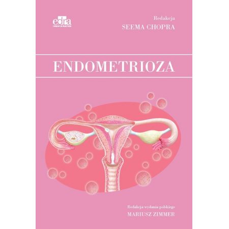 Endometrioza