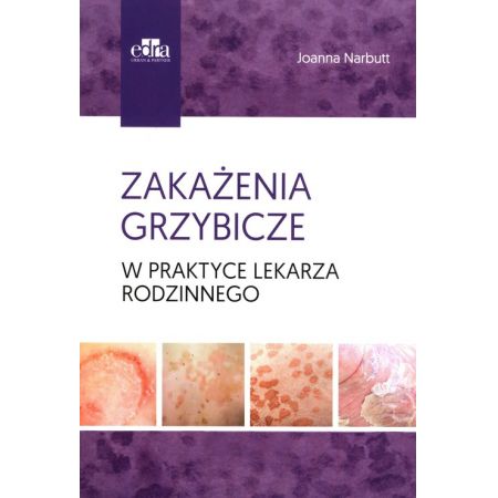 Zakażenia grzybicze w praktyce lekarza rodzinnego