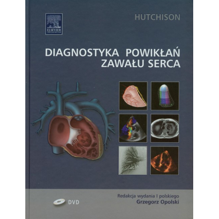 Diagnostyka powikłań zawału serca