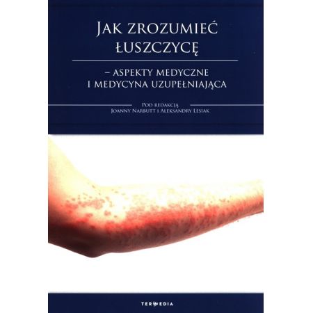 Jak zrozumieć łuszczycę?