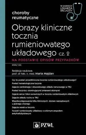 Obrazy kliniczne tocznia rumieniowatego układowego. Część 2