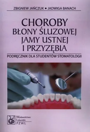 Choroby błony śluzowej jamy ustnej i przyzębia. Podręcznik dla studentów stomatologii