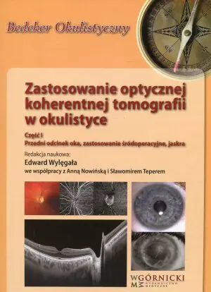 Zastosowanie optycznej koherentnej tomografii w okulistyce. Część 1. Przedni odcinek oka, zastosowanie śródoperacyjne, jaskra