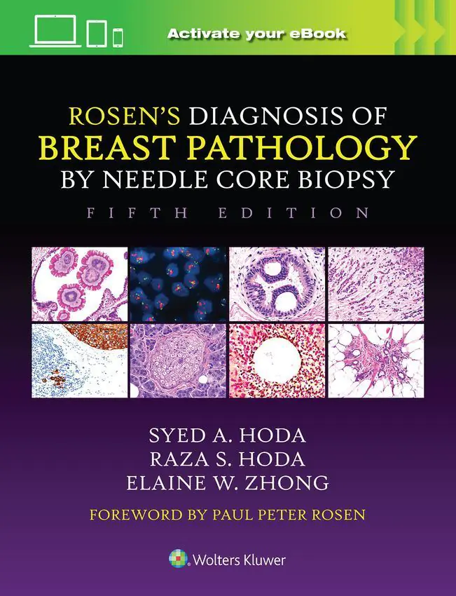 Książka - Rosen's Diagnosis of Breast Pathology by Needle Core Biopsy