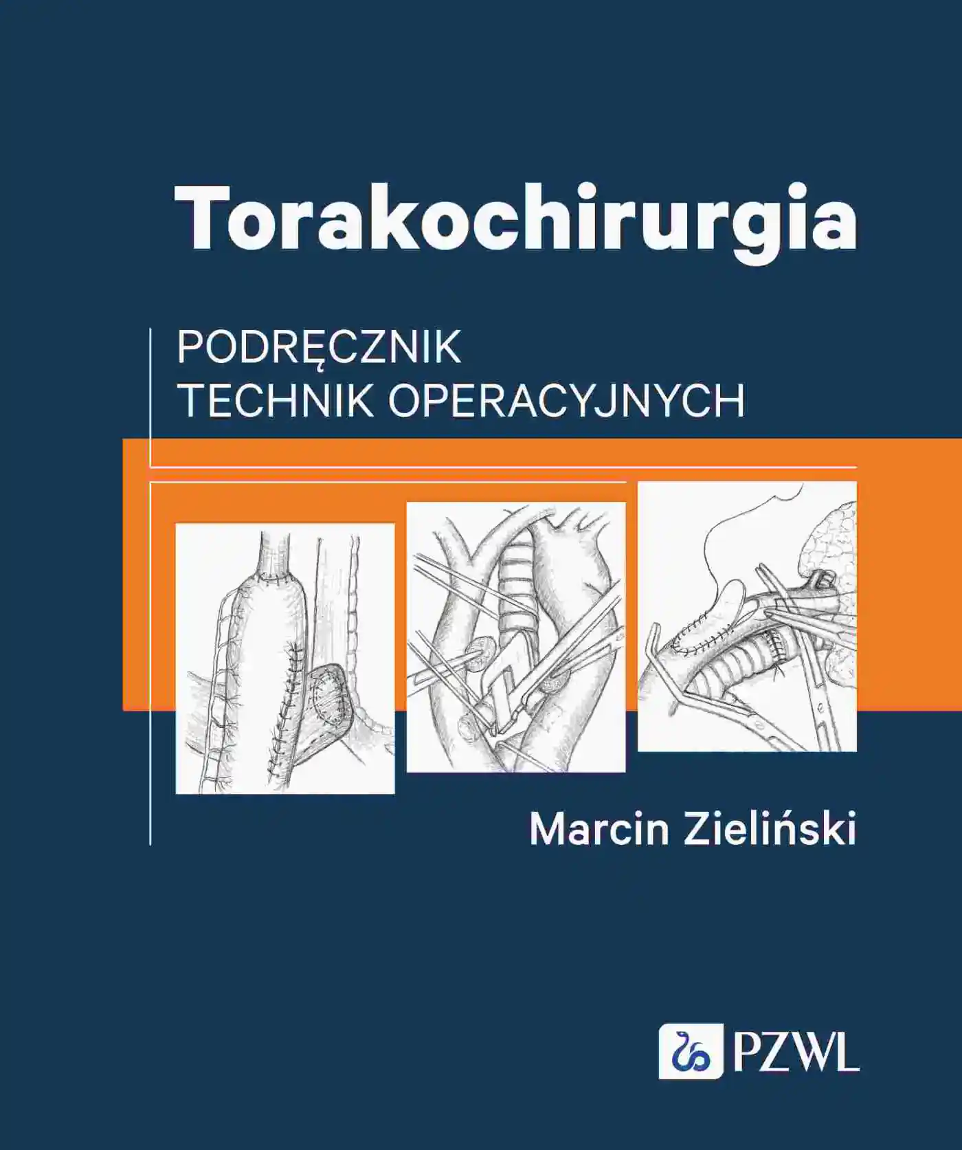Książka - Torakochirurgia. Podręcznik technik operacyjnych