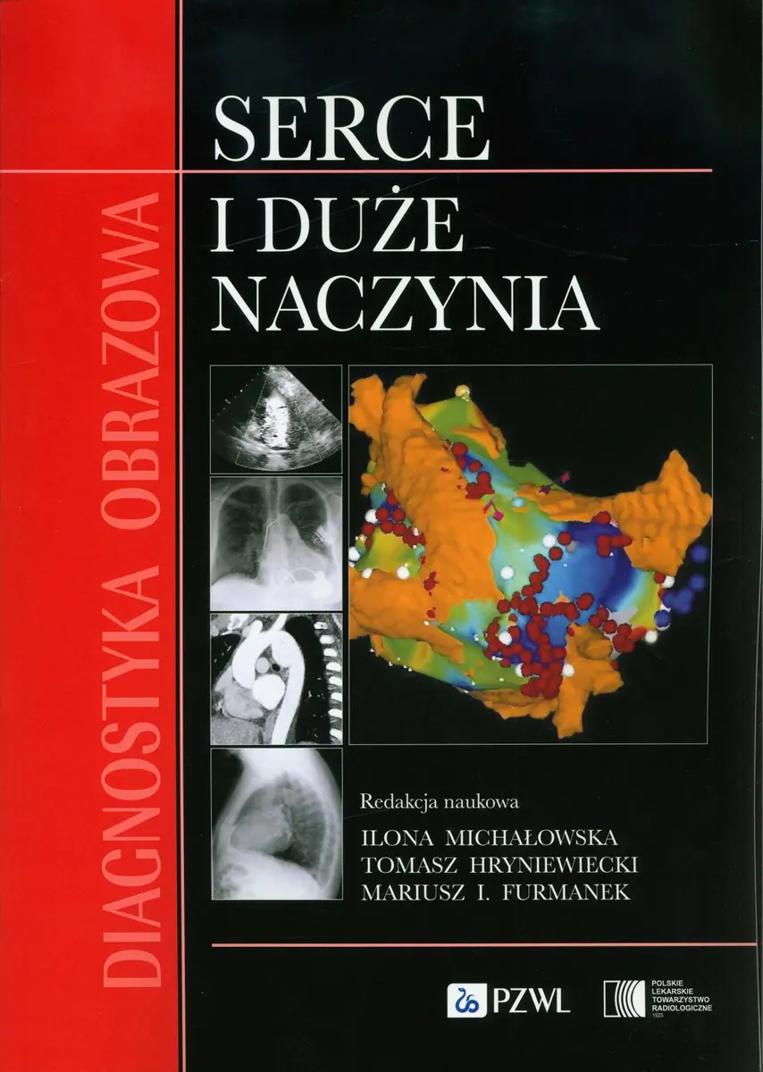 Książka - Diagnostyka obrazowa Serce i duże naczynia