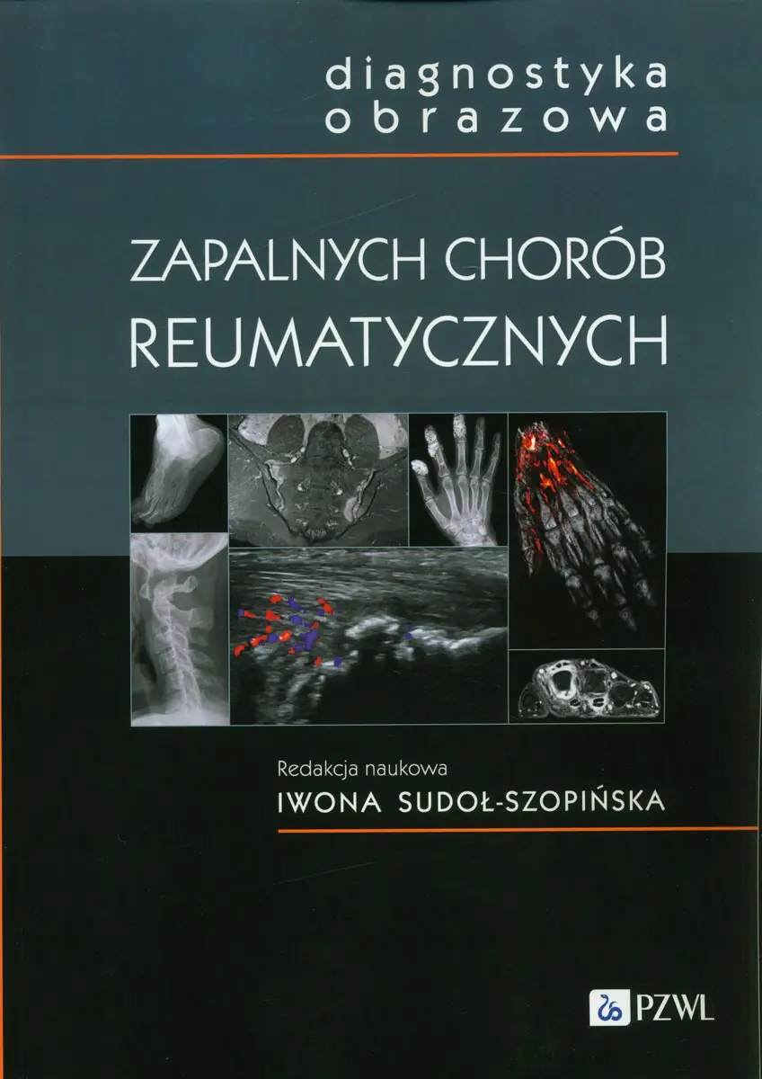 Książka - Diagnostyka obrazowa zapalnych chorób reumatycznych
