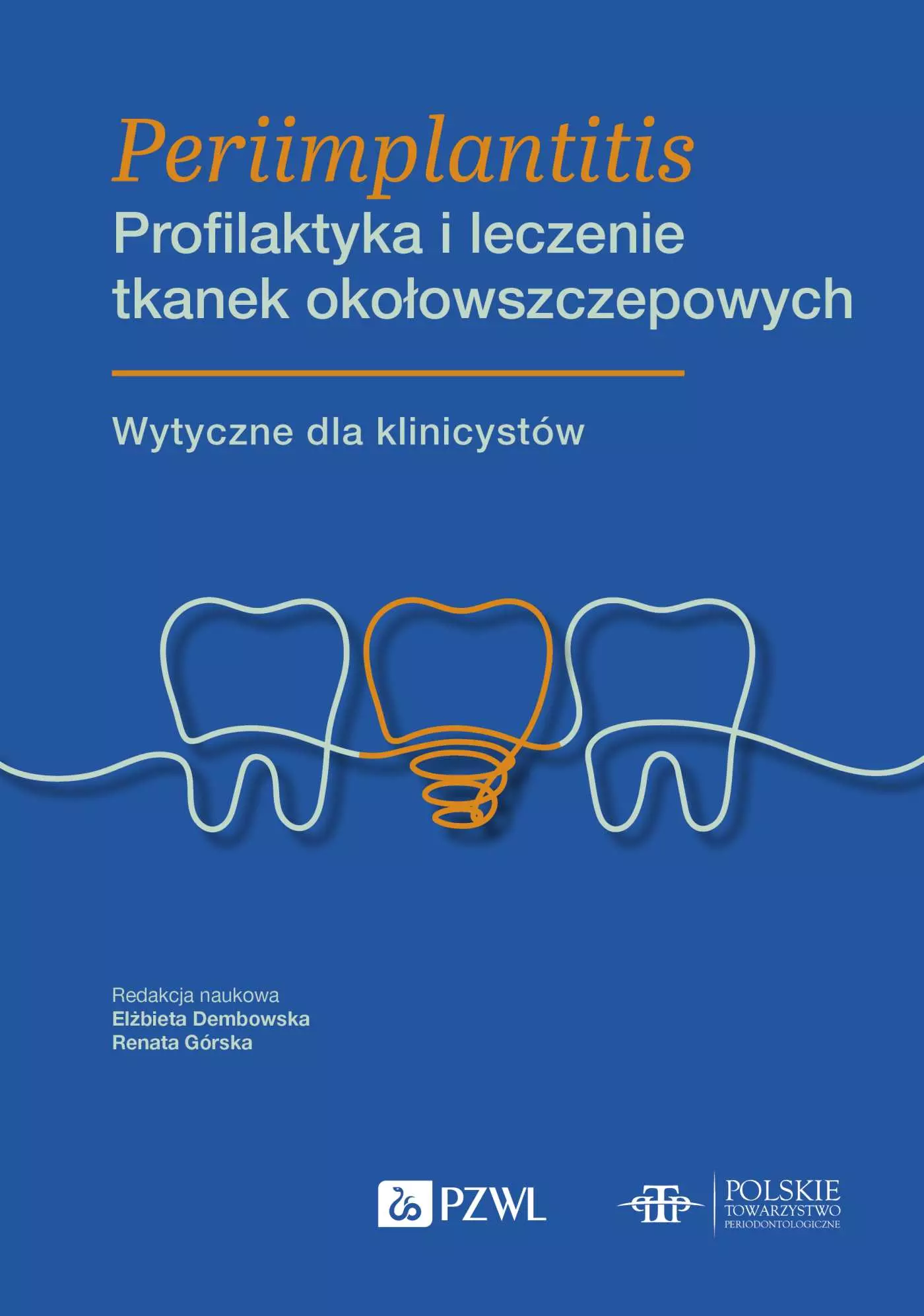 Książka - Periimplantitis. Profilaktyka i leczenie tkanek okołowszczepowych