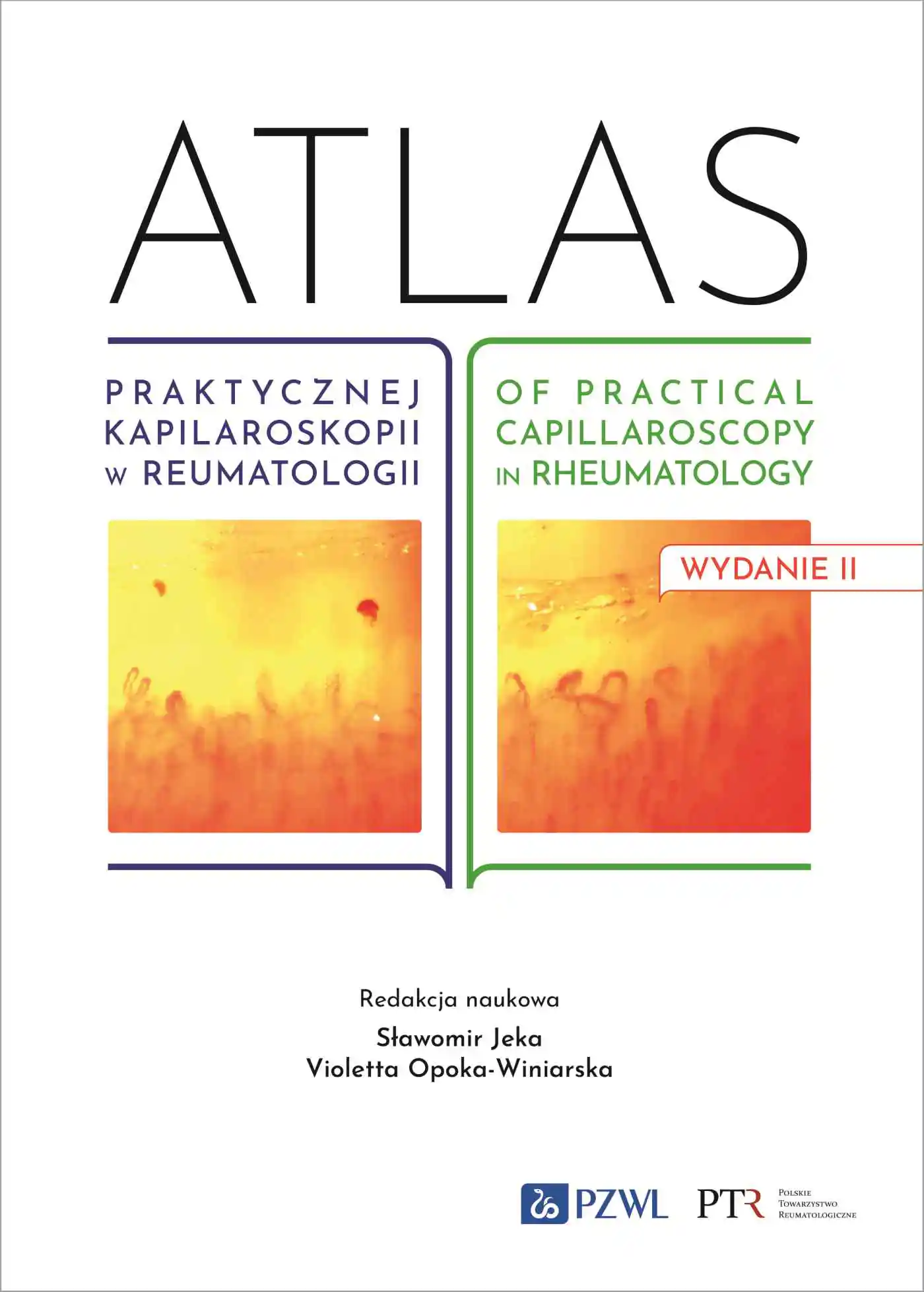 Książka - Atlas praktycznej kapilaroskopii w reumatologii. Atlas of practical capillaroscopy in rheumatology
