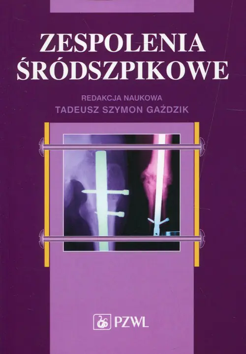 Książka - Zespolenia śródszpikowe