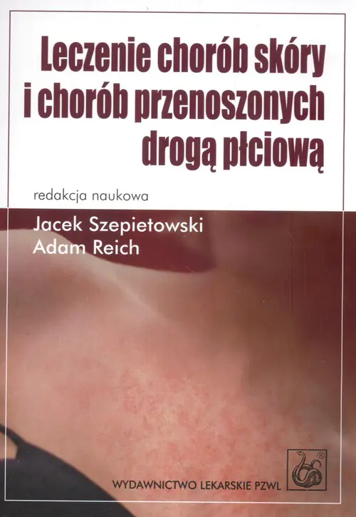 Książka - Leczenie chorób skóry i chorób przenoszonych drogą płciową