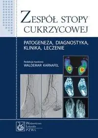 Książka - Zespół stopy cukrzycowej. Patogeneza, diagnostyka, klinika, leczenie