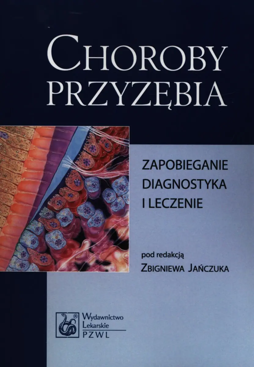 Książka - Choroby przyzębia