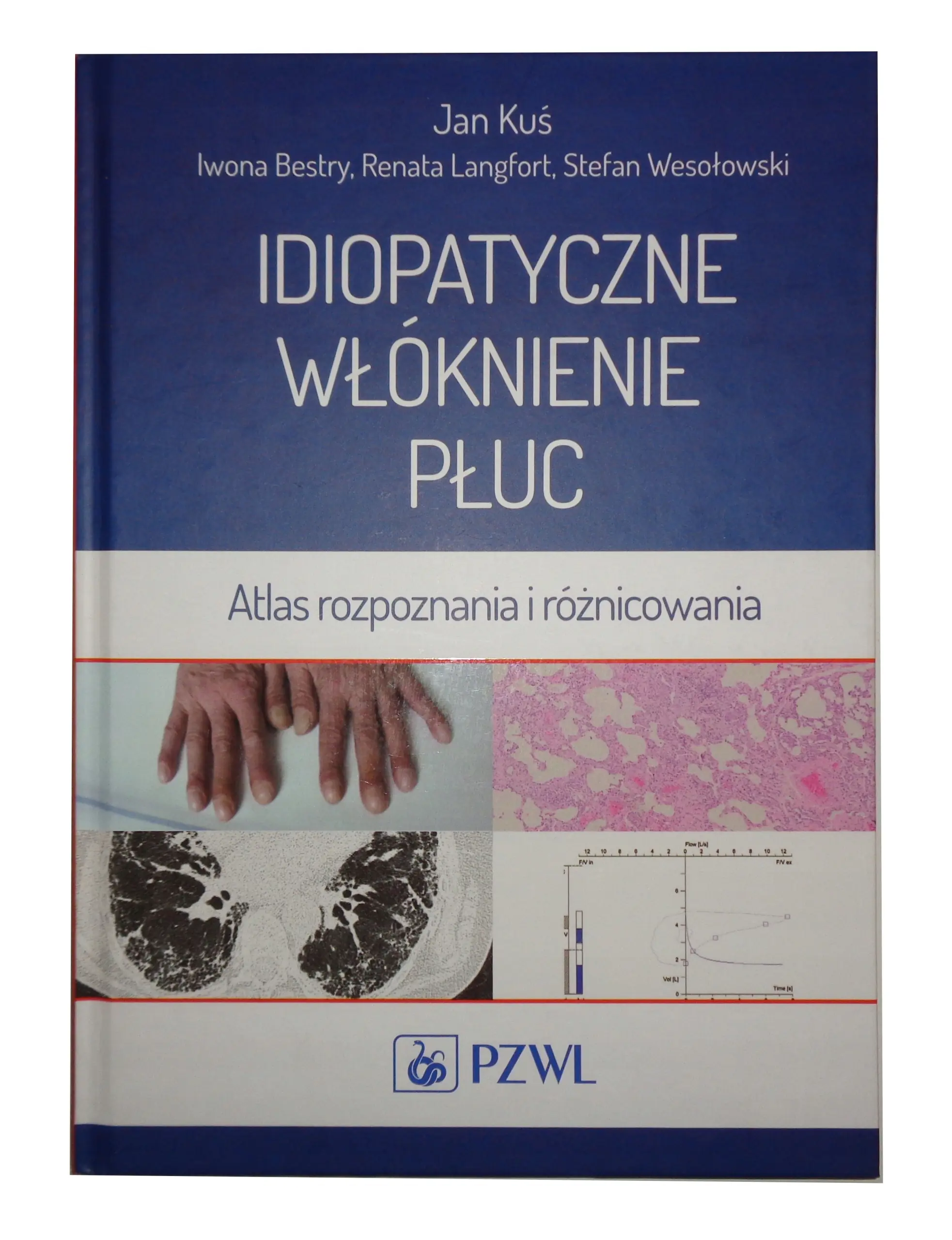 Książka - Idiopatyczne włóknienie płuc