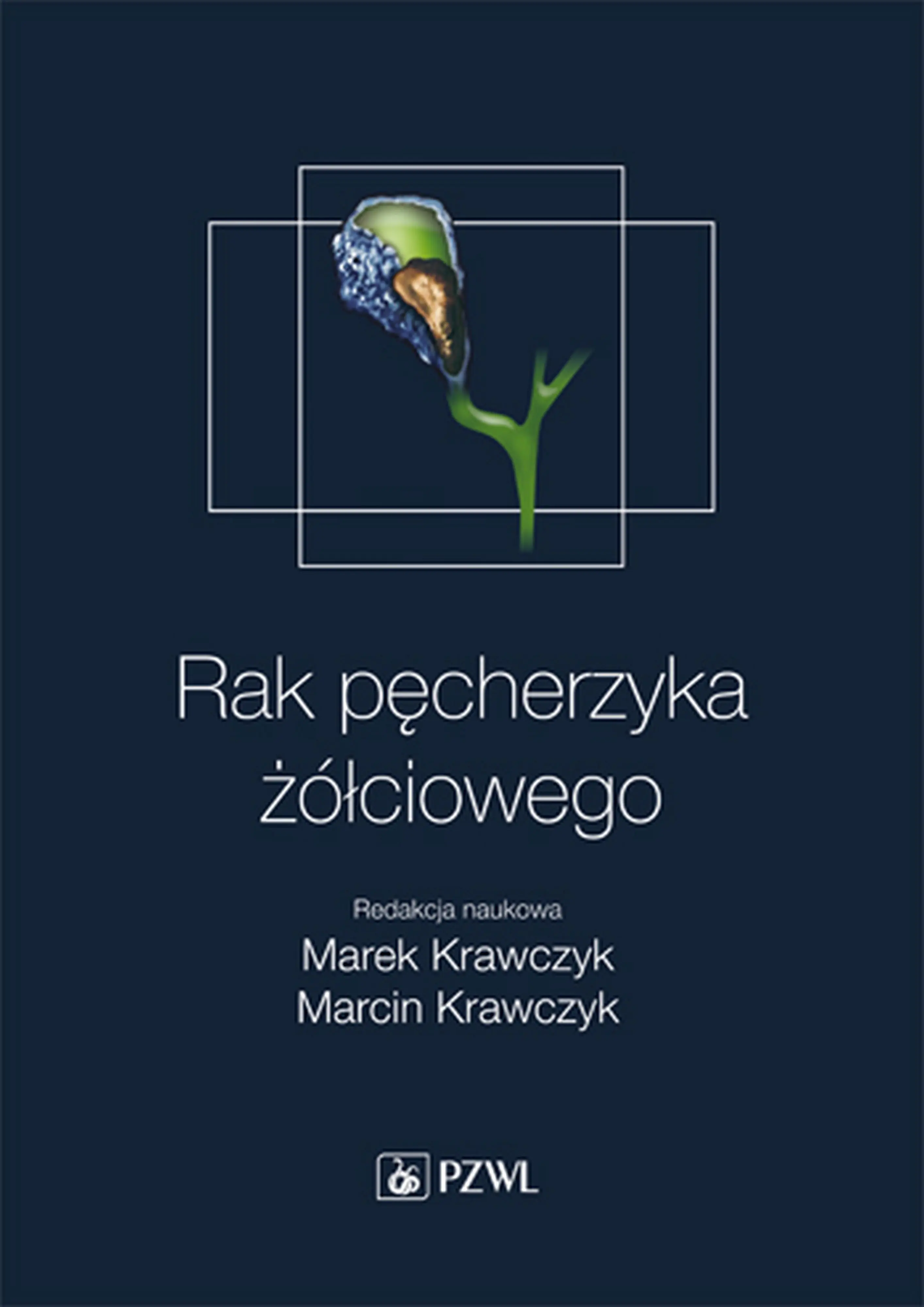 Książka - Rak pęcherzyka żółciowego