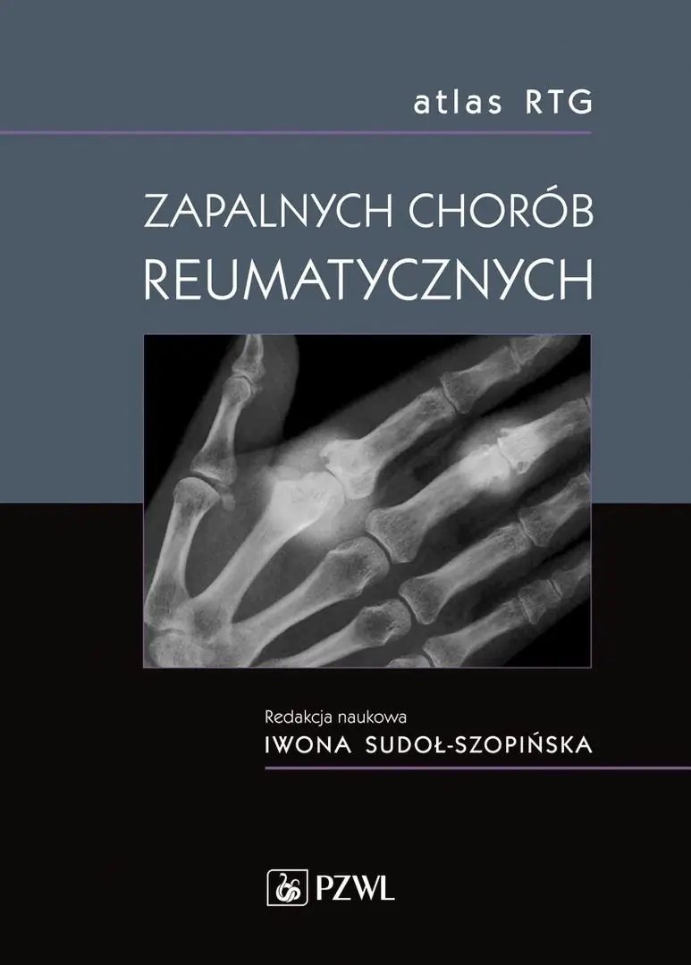 Książka - Atlas RTG zapalnych chorób reumatycznych