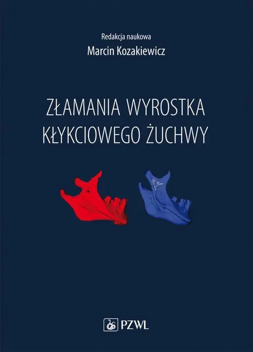 Książka - Złamania wyrostka kłykciowego żuchwy