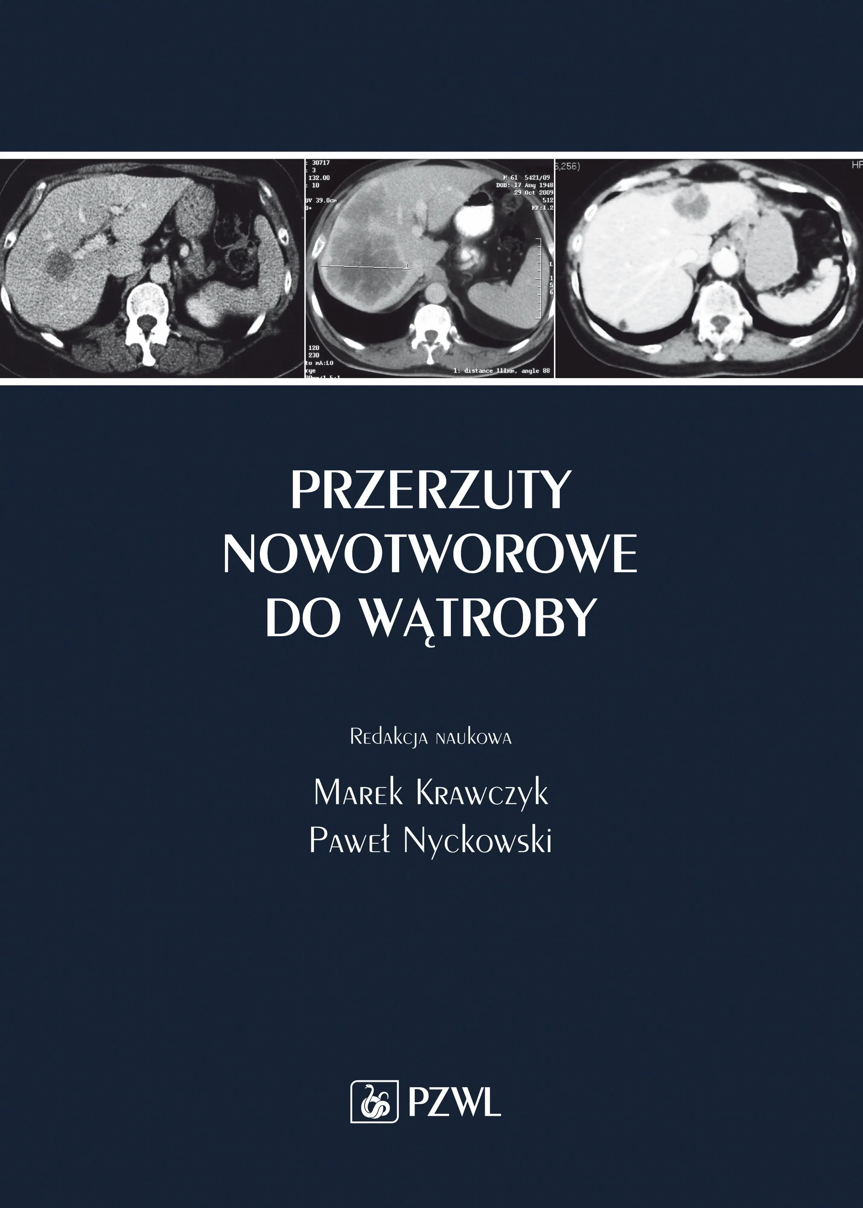 Książka - Przerzuty nowotworowe do wątroby