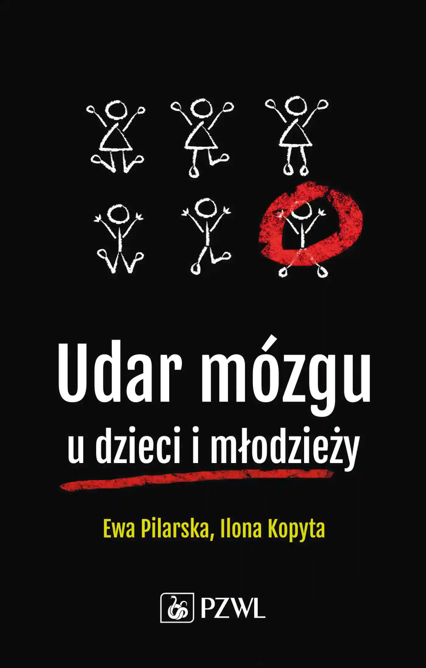 Książka - Udar mózgu u dzieci i młodzieży