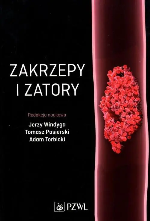 Książka - Zakrzepy i zatory