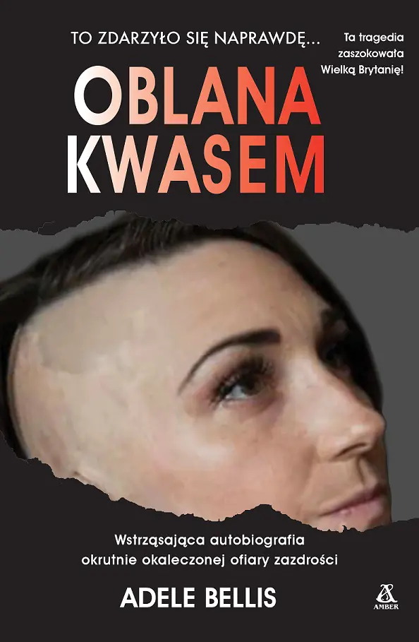 Książka - Oblana kwasem
