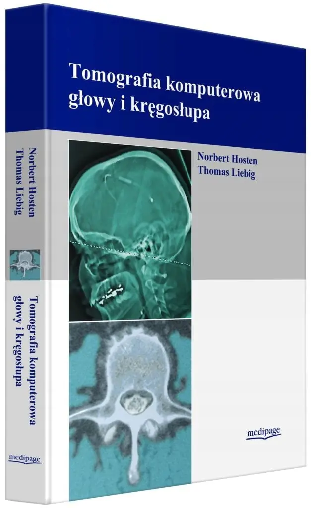 Książka - Tomografia komputerowa głowy i kręgosłupa
