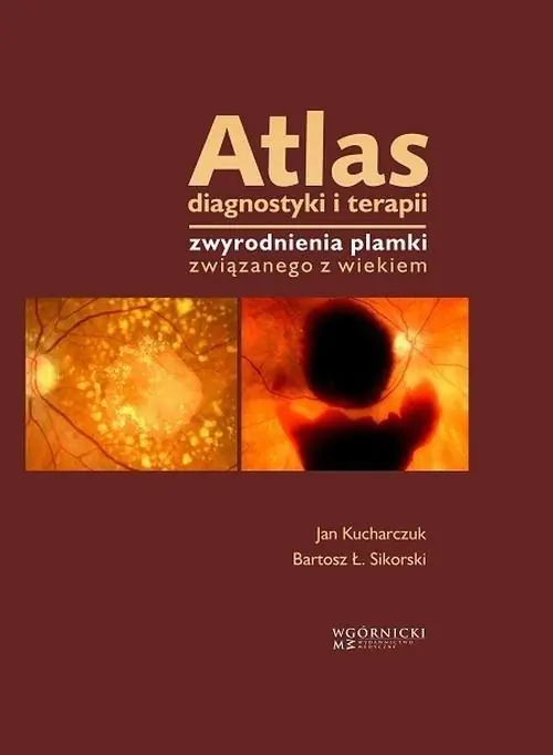Książka - Atlas diagnostyki i terapii zwyrodnienia plamki związanego z wiekiem