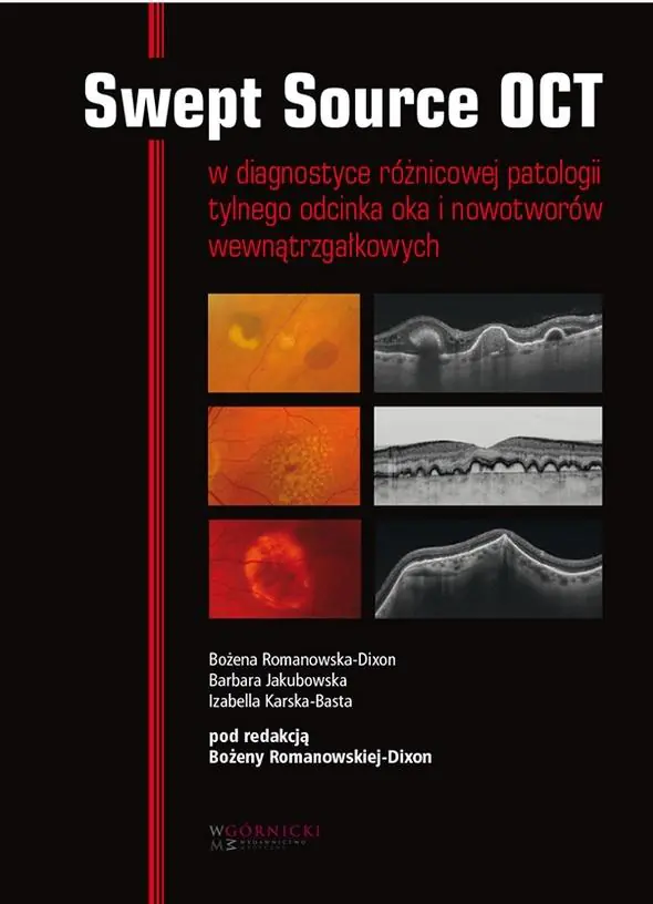 Książka - Swept Source OCT w diagnostyce patologii tylnego bieguna oka i nowotworów wewnątrzgałkowych