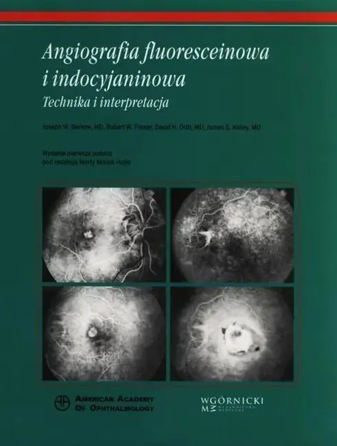 Książka - Angiografia fluoresceinowa i indocyjaninowa