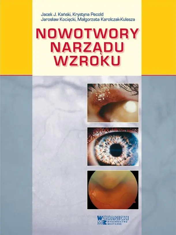 Książka - Nowotwory narządu wzroku