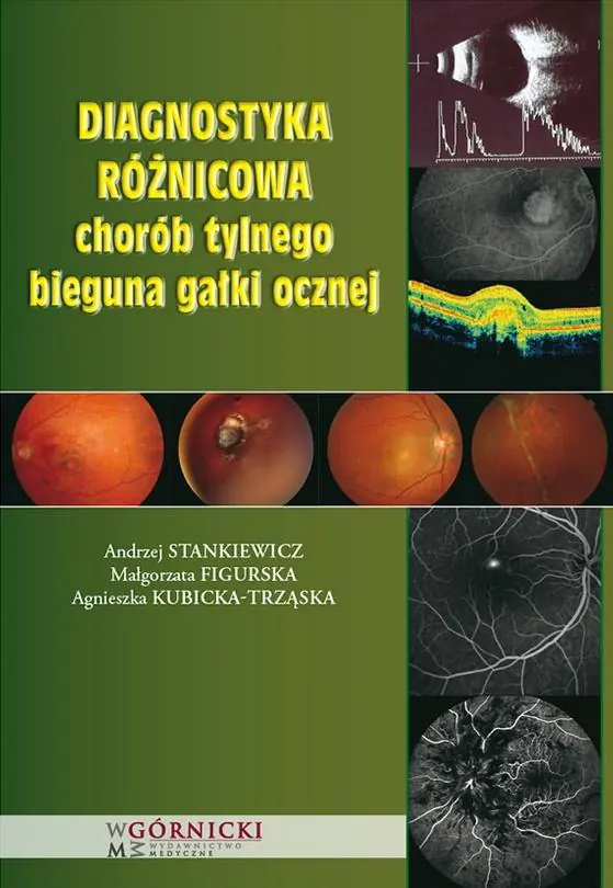Książka - Diagnostyka różnicowa chorób tylnego bieguna gałki ocznej