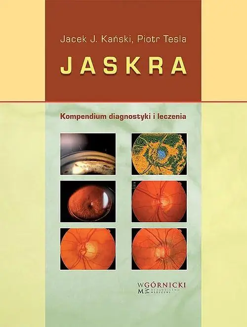 Książka - Jaskra. Kompendium diagnostyki i leczenia