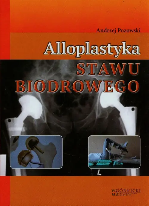 Książka - Alloplastyka stawu biodrowego