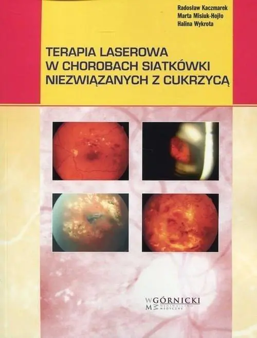 Książka - Terapia laserowa w chorobach siatkówki niezwiązanych z cukrzycą