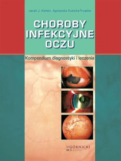 Książka - Choroby infekcyjne oczu. Kompendium diagnostyki i leczenia