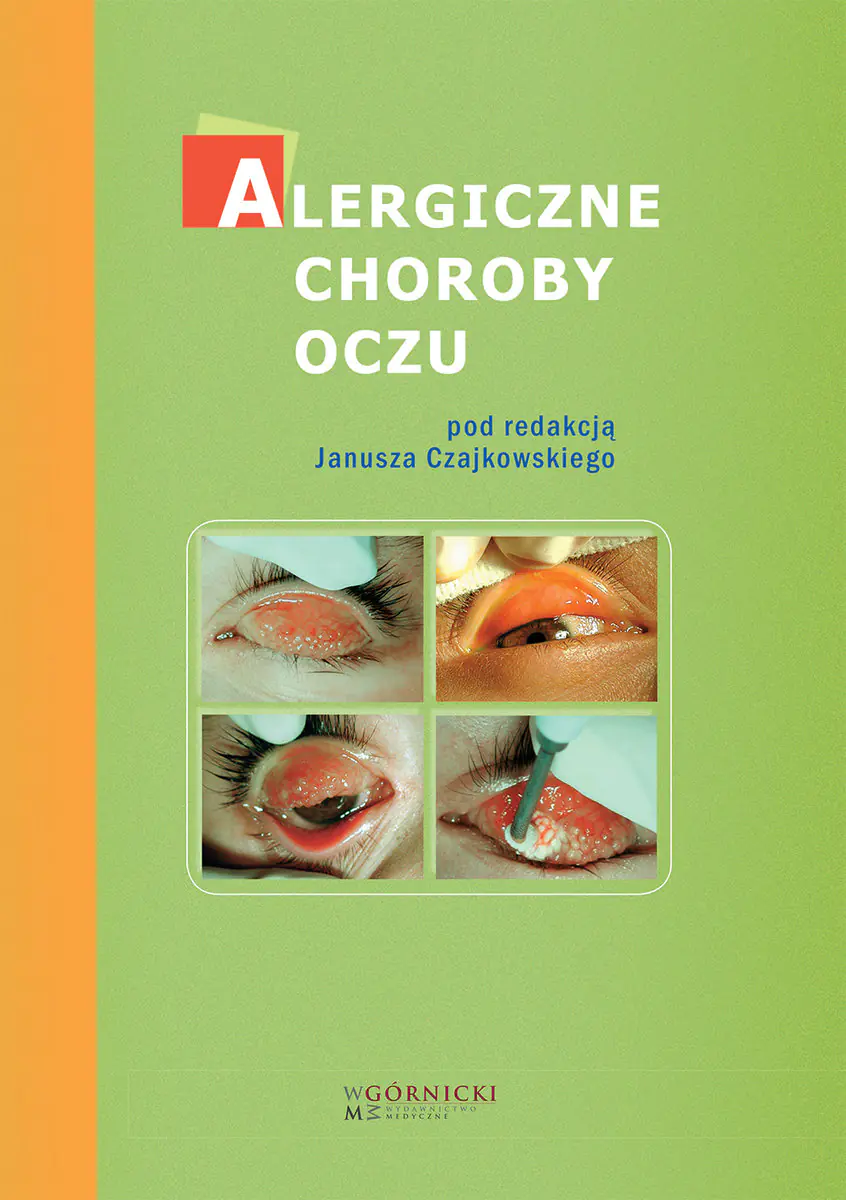 Książka - Alergiczne choroby oczu