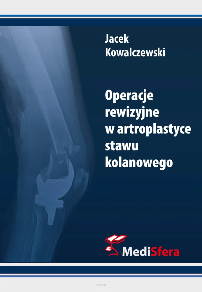 Książka - OPERACJE REWIZYJNE W ARTROPLASTYCE STAWU KOLANOWEG