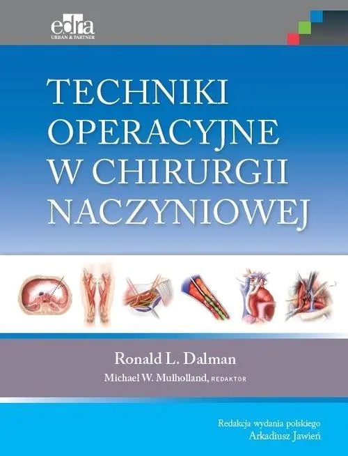 Książka - Techniki operacyjne w chirurgii naczyniowej
