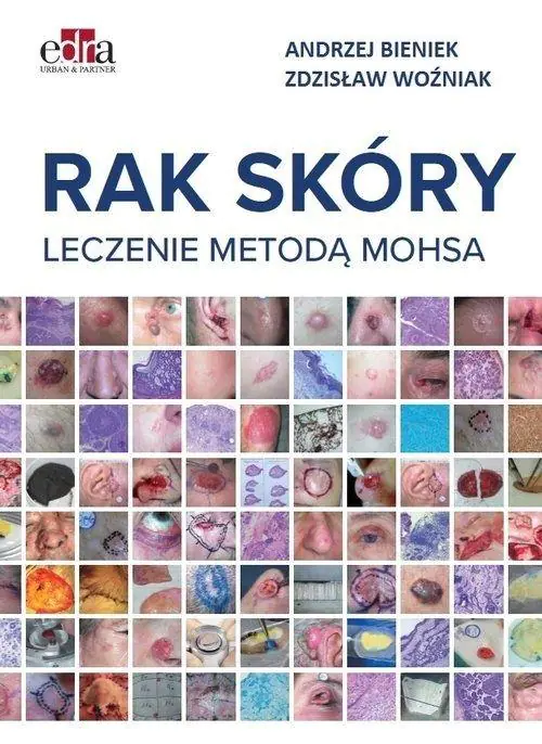 Książka - Rak skóry. Leczenie metodą Mohsa