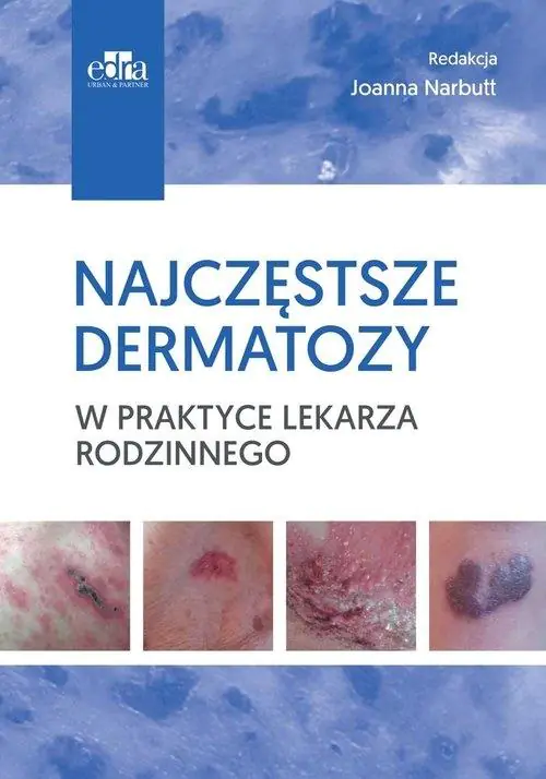 Książka - Najczęstsze dermatozy w praktyce lekarza rodzinnego