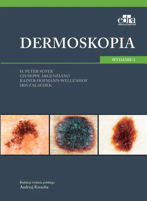 Książka - Dermoskopia
