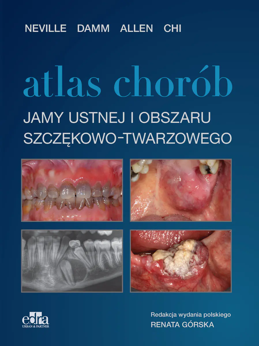 Książka - Atlas chorób jamy ustnej i obszaru szczękowo-twarzowego