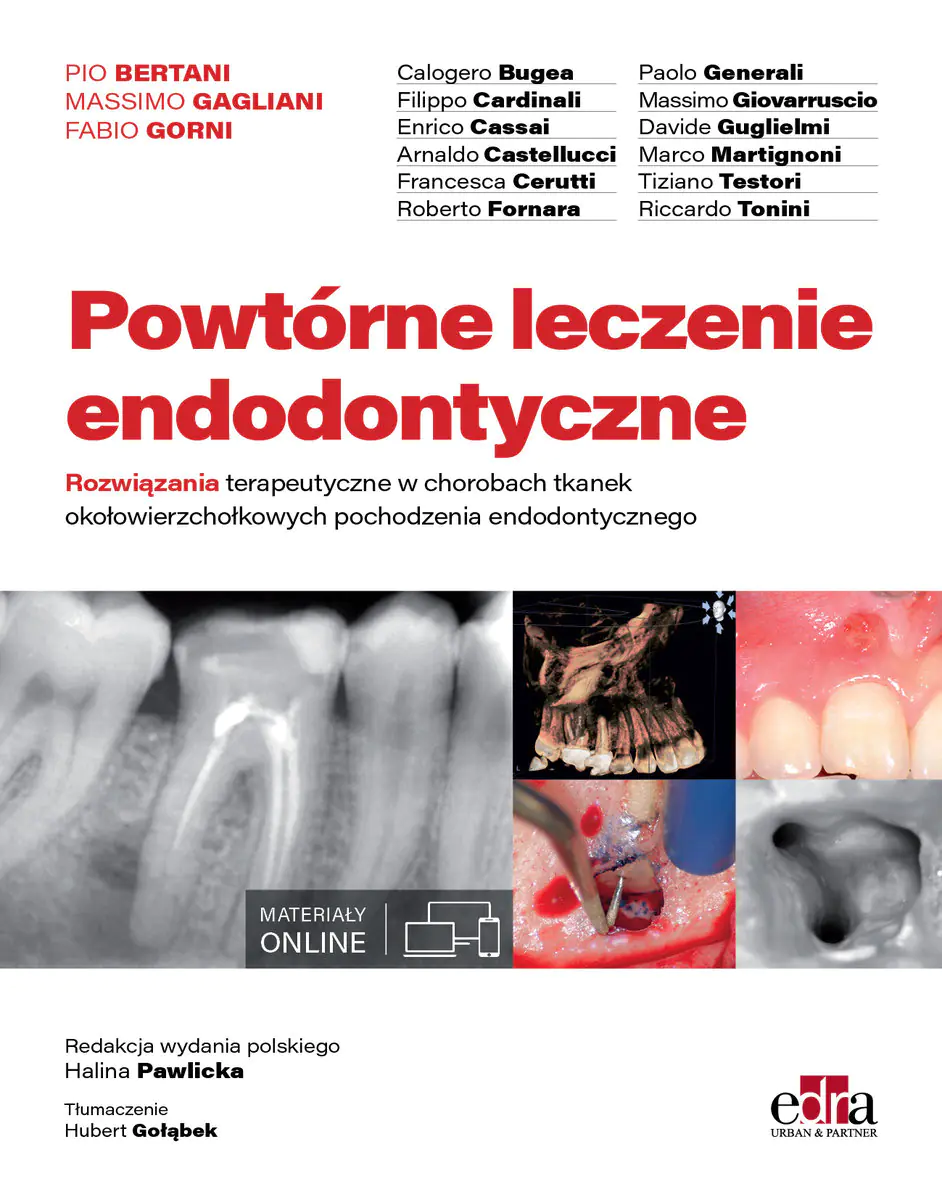 Książka - Powtórne leczenie endodontyczne