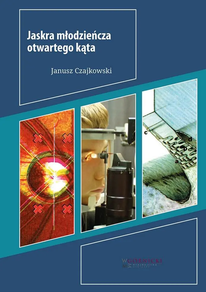 Książka - Jaskra młodzieńcza otwartego kąta