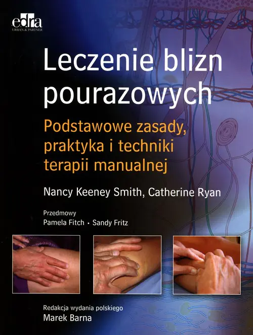 Książka - Leczenie blizn pourazowych