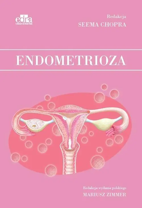 Książka - Endometrioza