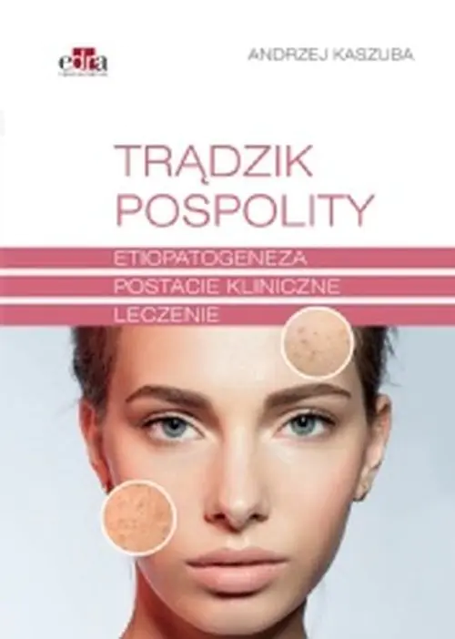 Książka - Trądzik pospolity