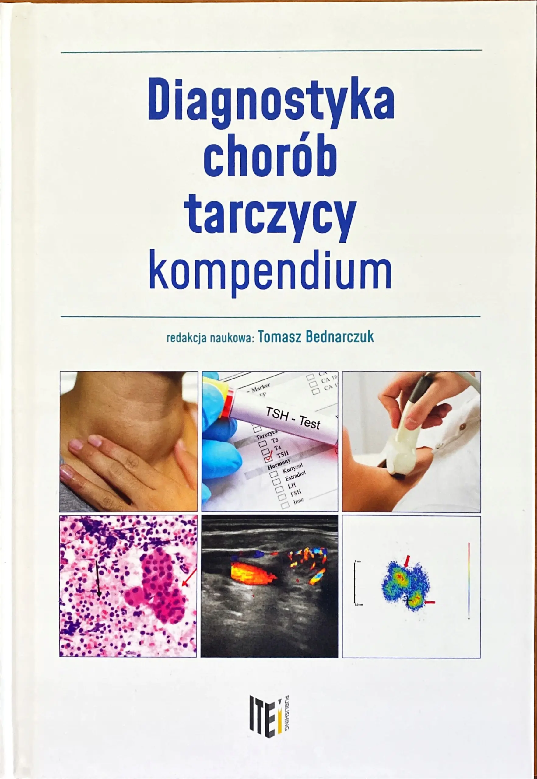 Książka - Diagnostyka chorób tarczycy. Kompendium